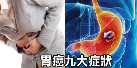 愛吃油炸當心「胃癌」上身！一秒檢測「九大早期徵兆」：噁心、腹脹、胃灼熱都進榜｜每日健康 Health