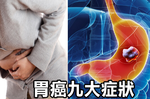 愛吃油炸當心「胃癌」上身！一秒檢測「九大早期徵兆」：噁心、腹脹、胃灼熱都進榜｜每日健康 Health