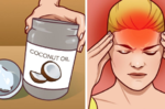 「頭痛」不必再吃止痛藥！「椰子油」這樣用，快速解痛自己來｜每日健康Health