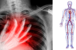 天冷死亡率破30%！急性「心臟病」四大指數一秒自測，低於這個數字最危險｜每日健康 Health