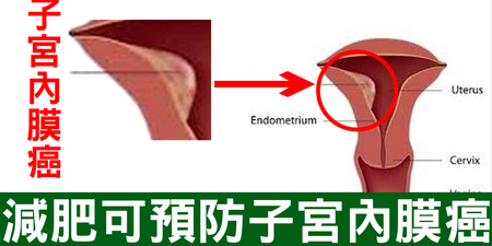 「瘦身」可以「抗癌」？「減肥抗癌法」瘦「兩到五公斤」，「降三到六成」癌機率！｜每日健康 Health