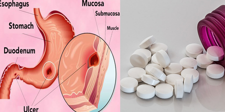 阿斯匹靈、消炎藥等「七種藥物」一定要「配飯吃」！空腹下肚「胃出血、潰瘍」風險直線激增！