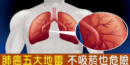 「肺癌五大地雷」每天這樣做，癌症發生率增加兩倍！吸菸者、非吸菸者都有危險！｜每日健康Health