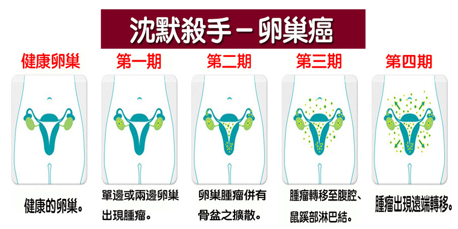 頻尿 腹脹 別輕忽 關於 卵巢癌 的早期四大警訊 不注意恐致命 每日健康health 每日健康health