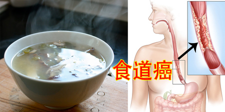 小心燙！消化黏膜不耐熱，超過耐熱溫度恐致【食道癌】！｜每日健康Health