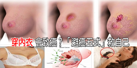 「穿內衣」是「乳癌」元兇？這七種人最危險｜每日健康 Health