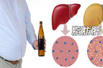 台灣罹患「脂肪肝」比例高達44%，「吃素」也有事！必學「6大要點」消滅肝臟脂肪｜每日健康Health