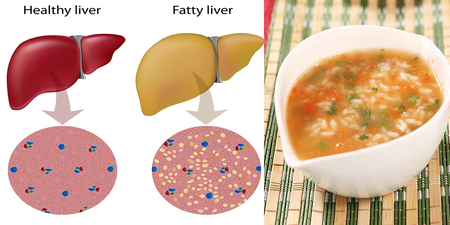 「脂肪肝」吃對食物就能救！2步驟「養生湯粥」增強免疫力、擊退有害自由基｜每日健康 Health