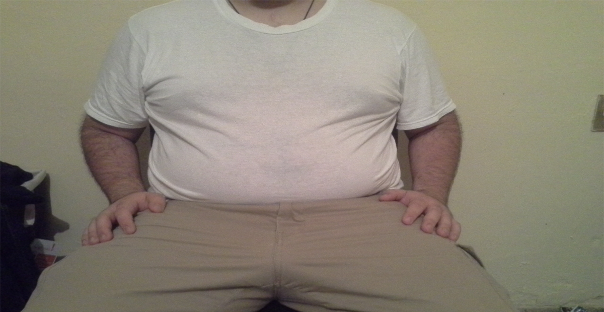 obesity