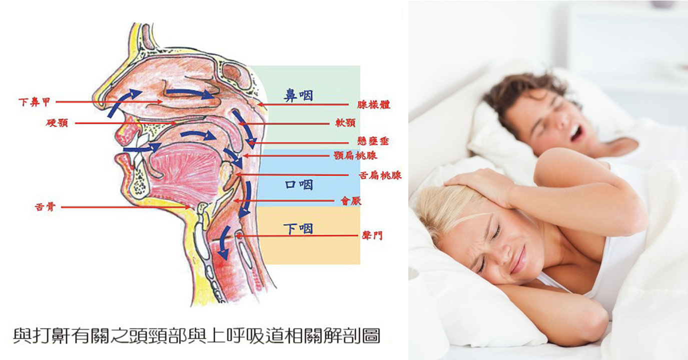 午夜列車--談鼾聲雷動