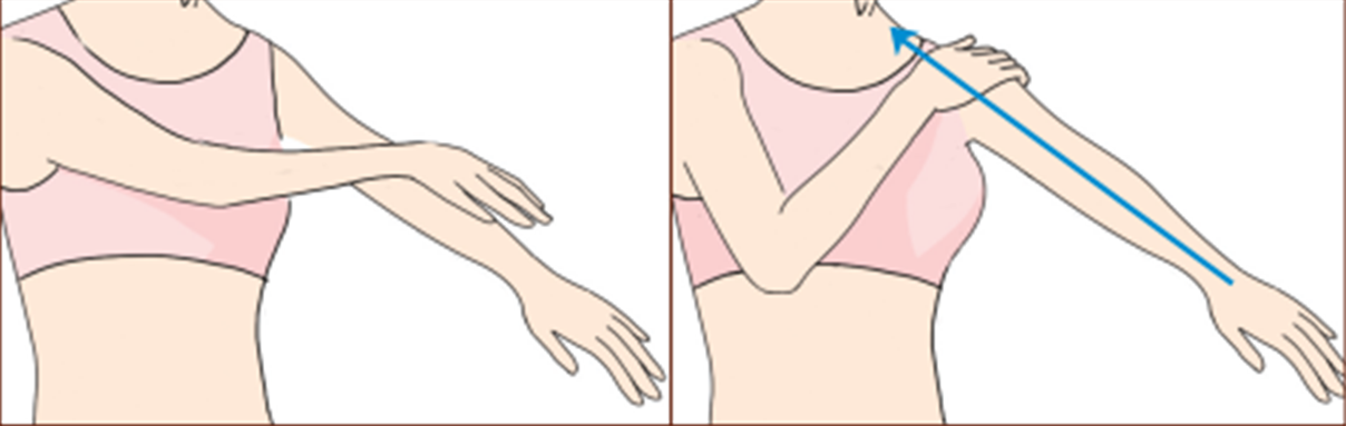 瘦手臂運動