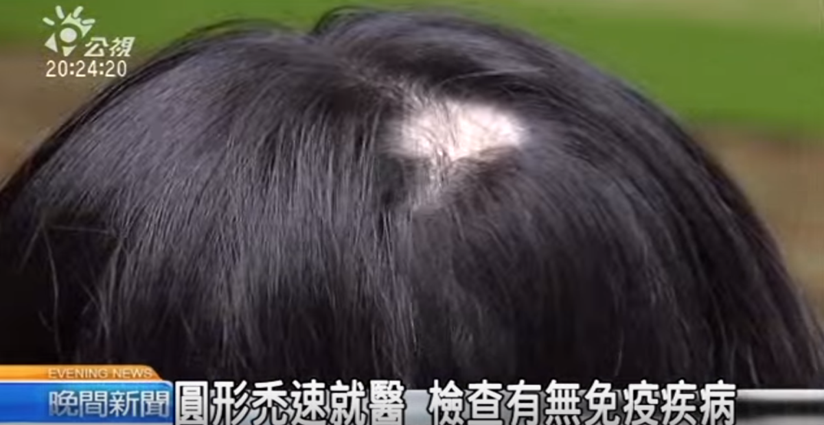 鬼剃頭