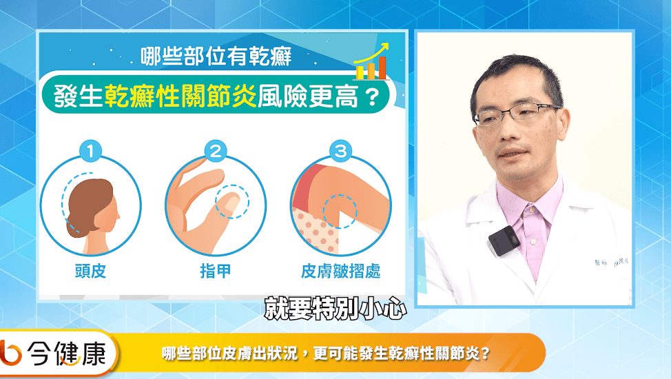 嘉義基督教醫院內科部過敏免疫風濕科陳俊銘醫師