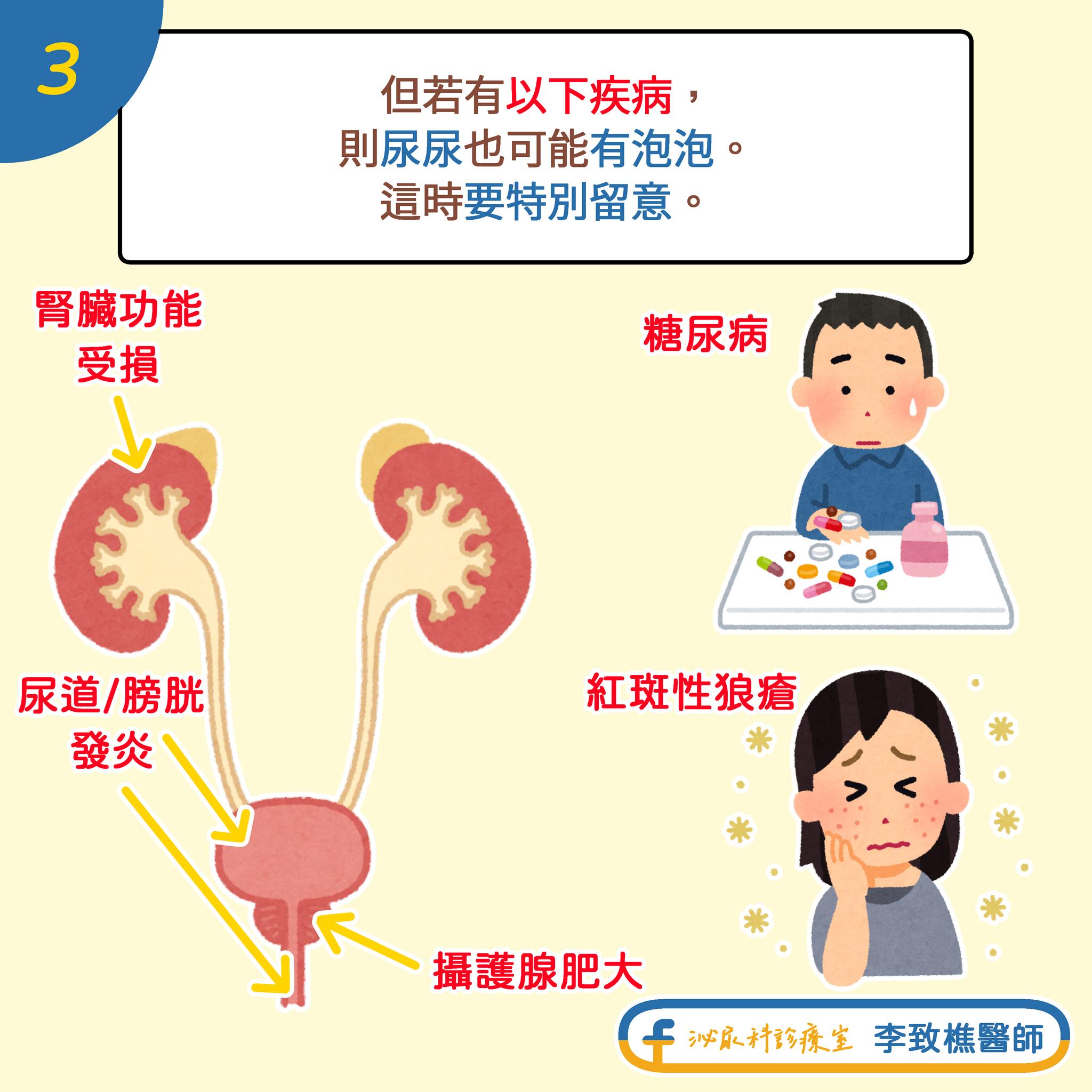 圖/翻攝自 臉書/泌尿科診療室 李致樵醫師