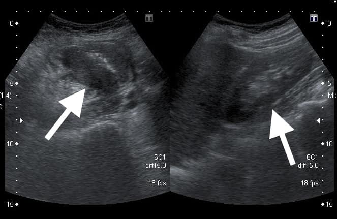圖/翻攝自 臉書/錢政弘 胃腸肝膽科醫師