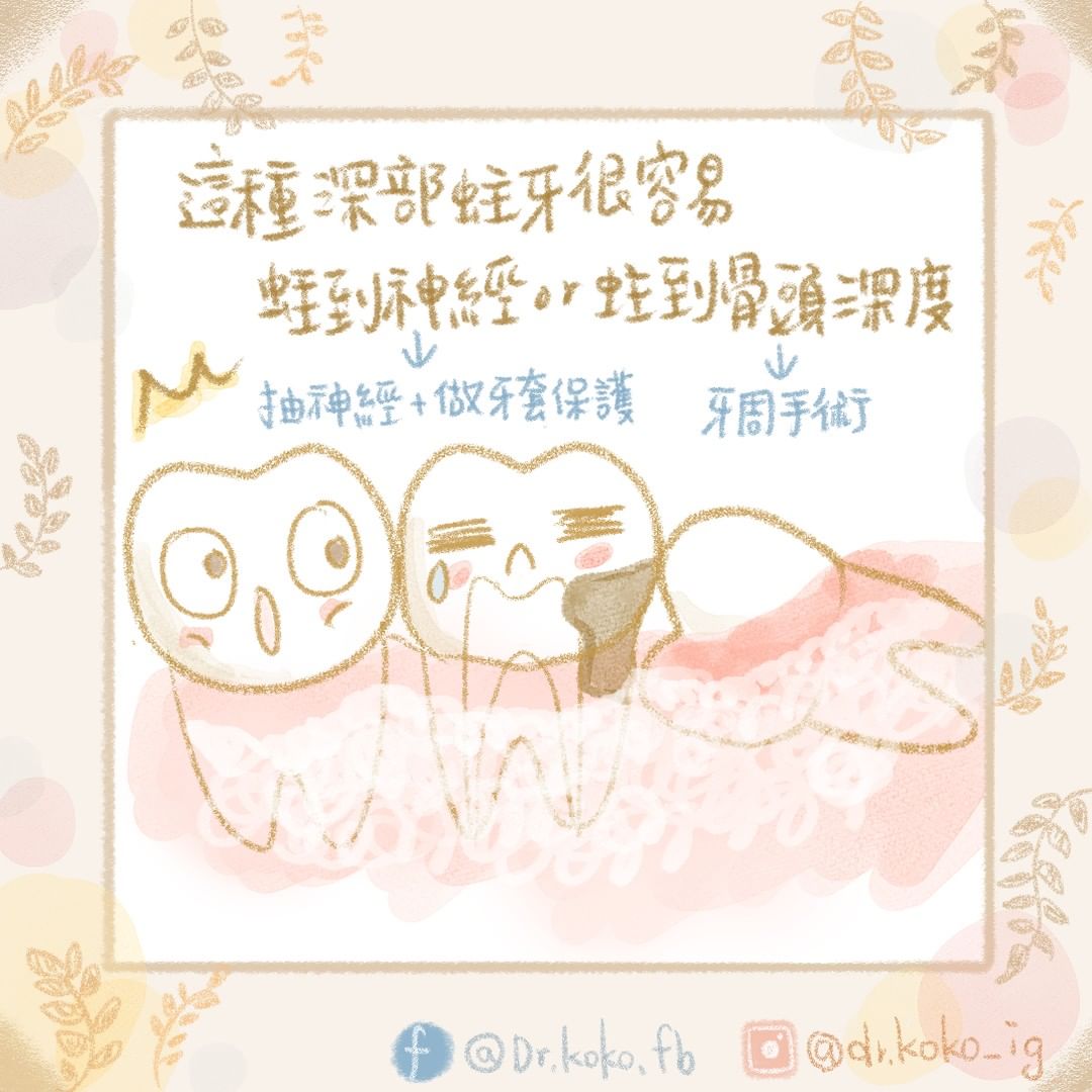 柯佩伶醫師 授權提供