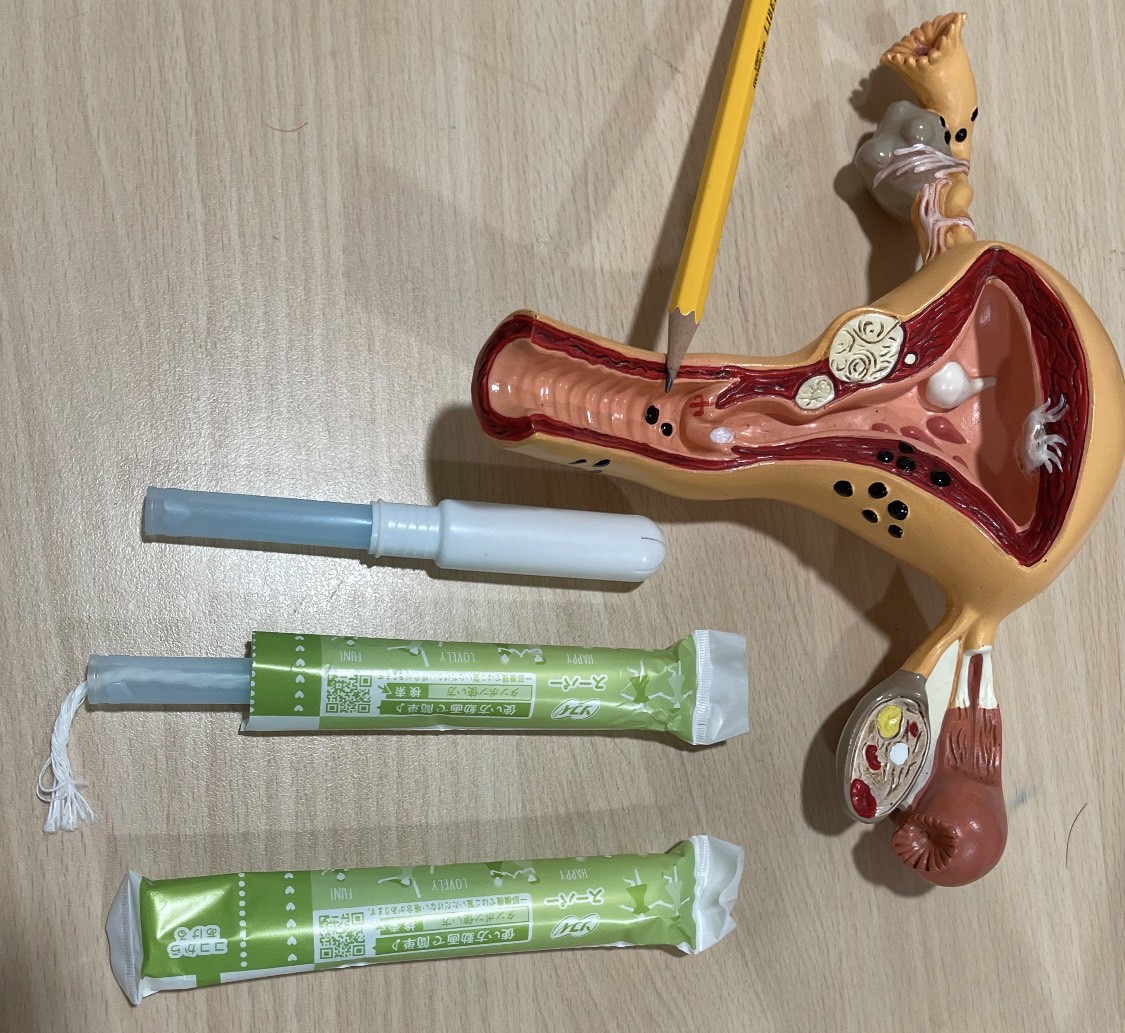 張宇琪醫師 授權提供