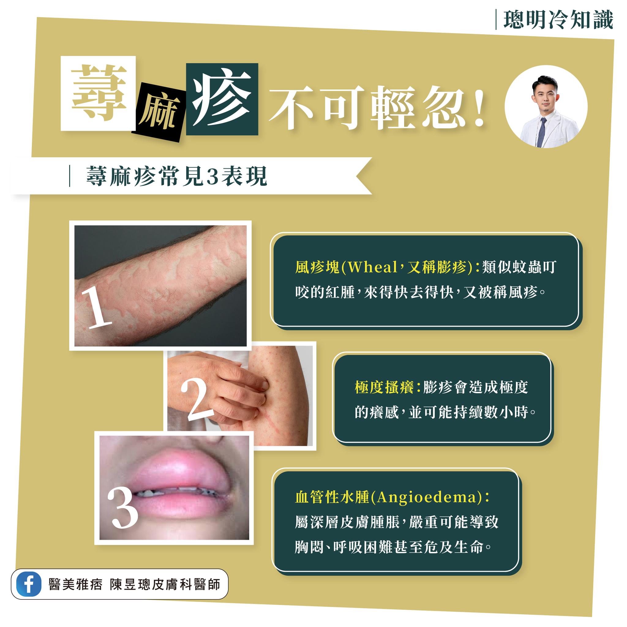 陳昱璁醫師 授權提供