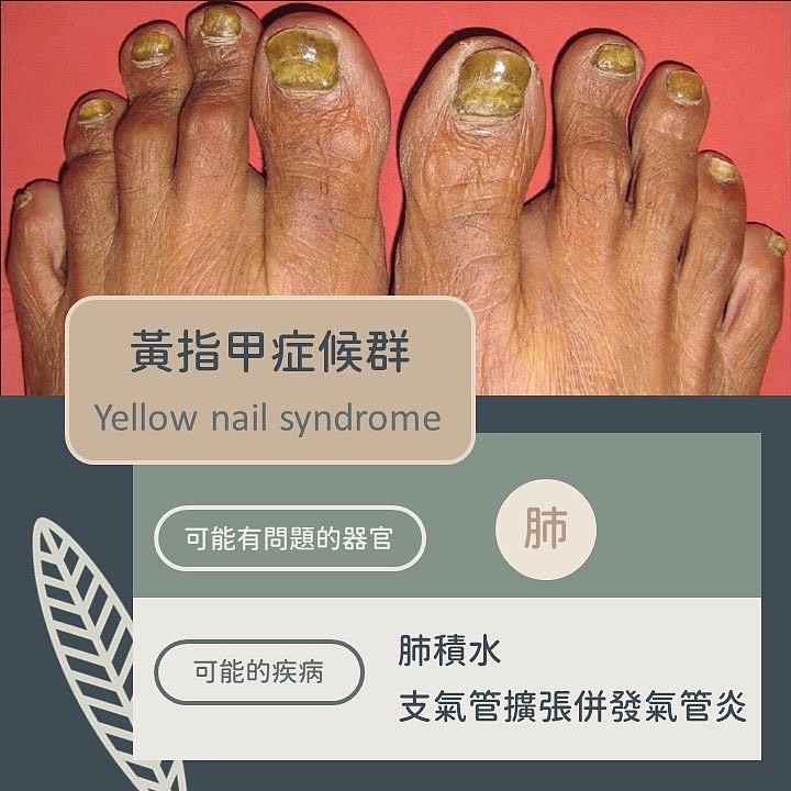 黃晨昊醫師 授權提供