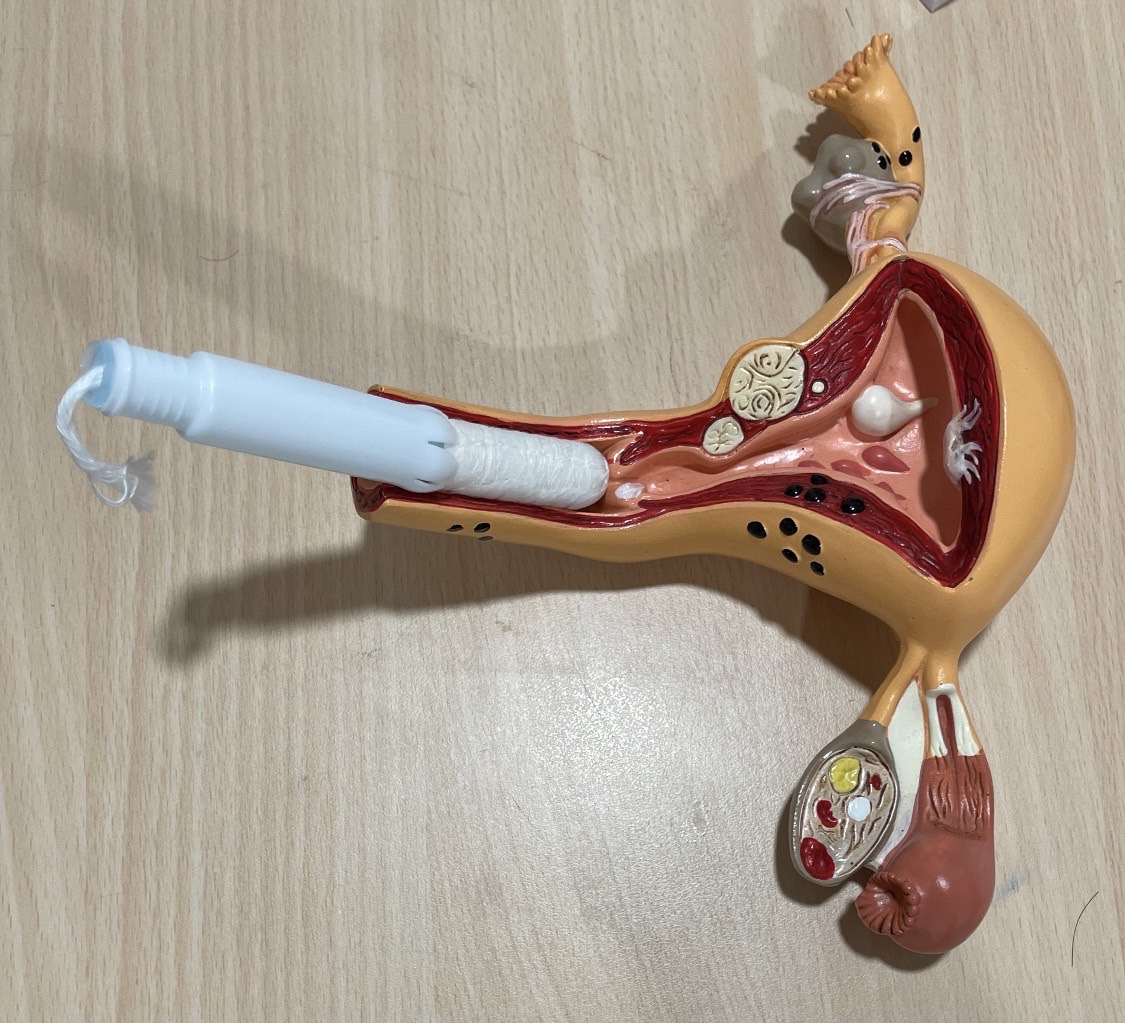 張宇琪醫師 授權提供