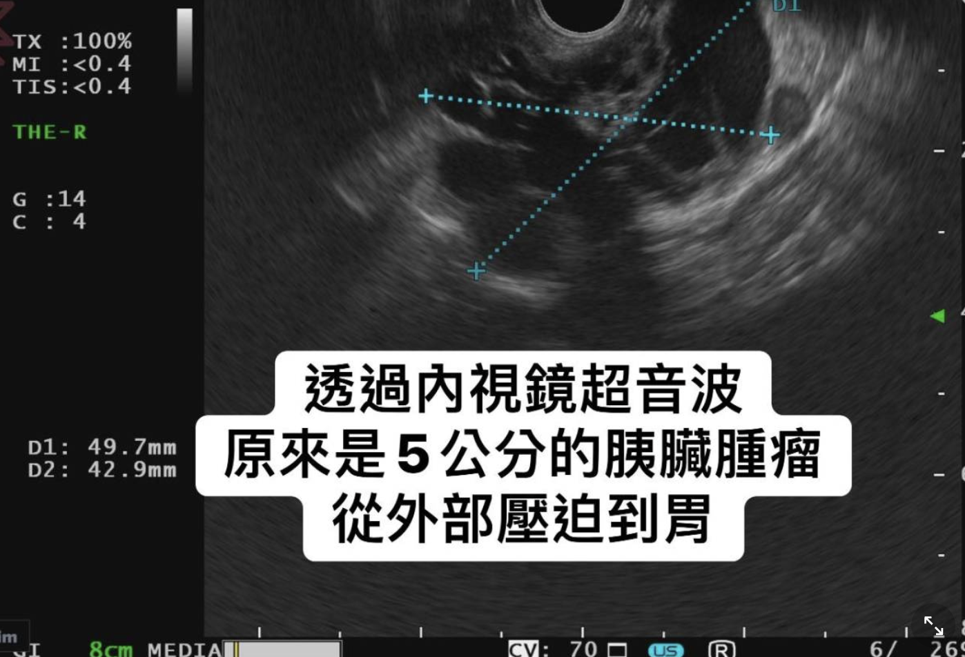 胰臟醫師 林相宏 禾馨民權內科診所