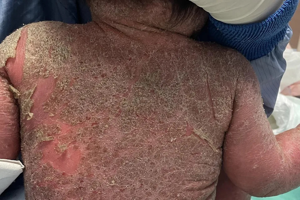 照片來源:台北慈濟醫院提供