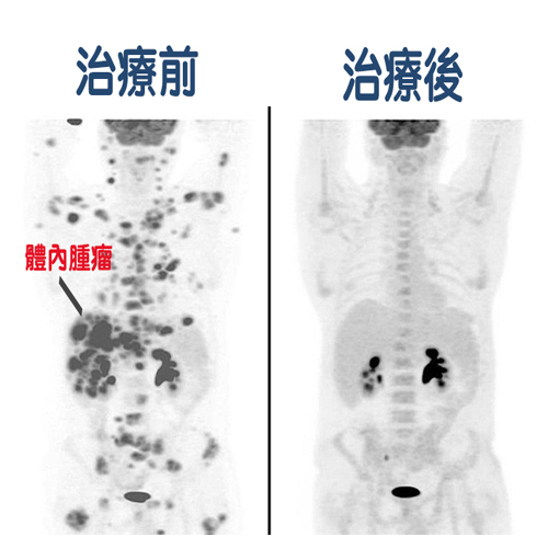 每日郵報